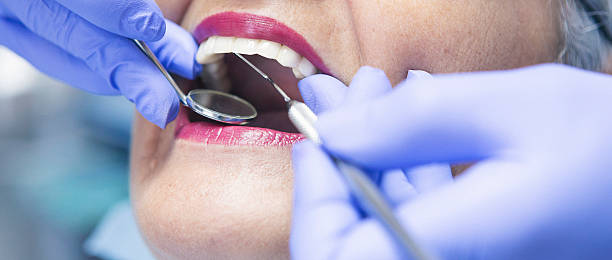 Best Weekend Emergency Dentist in Benicia, CA